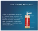 TheraLas 30 device, view 3